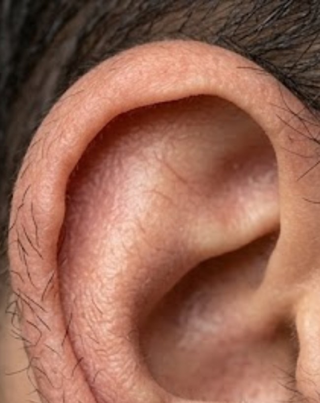 Hair On Ears-1-2-3-4-5-6