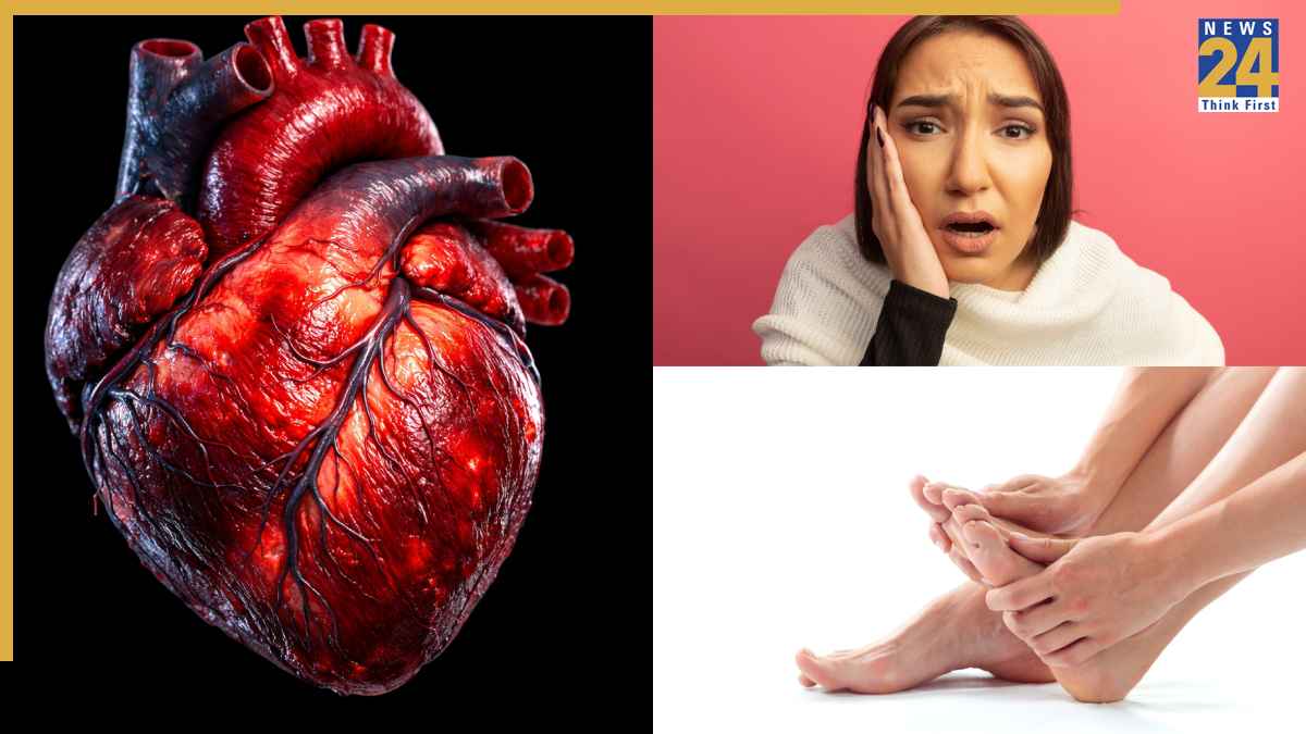 Heart Swelling Signs