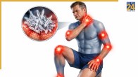 High Uric Acid