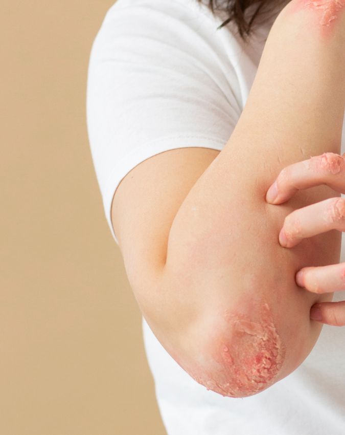 Kis Vitamin ki kami se khujli hoti hai-1-2-3-4-5-6