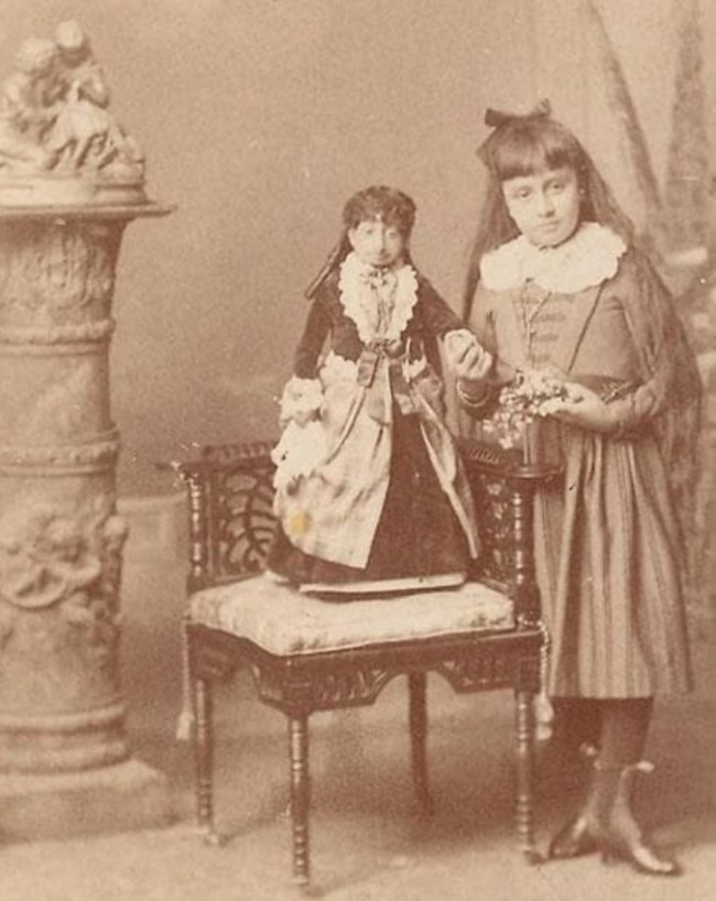 World Lightest Girl Weight Record-1-2