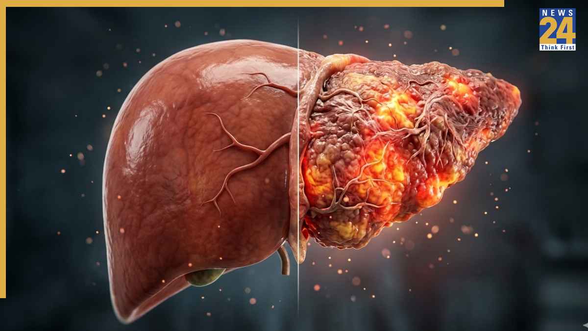 Liver Damage Symptoms Early Signs