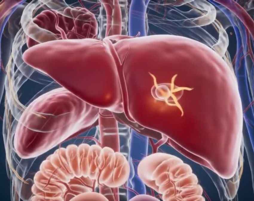 लिवर डैमेज में क्यों आता है बुखार?