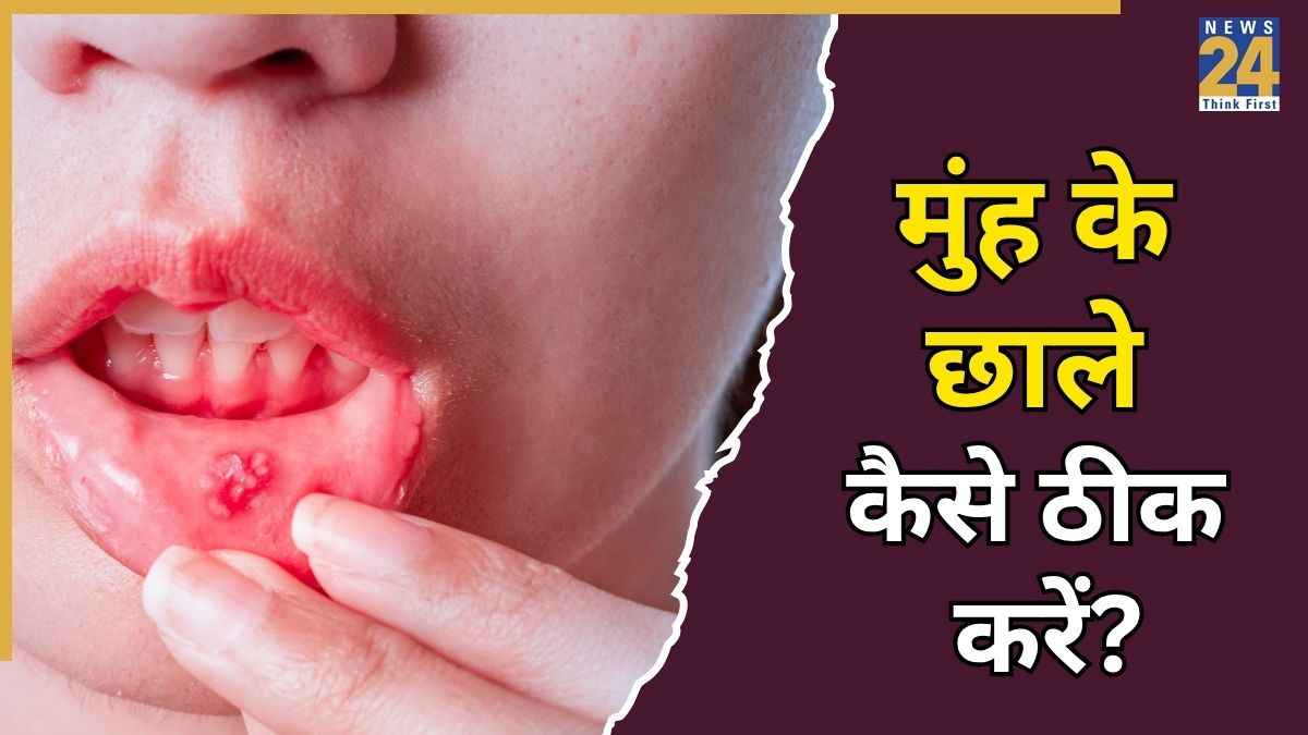Muh Ke Chale Kaise Theek Kare