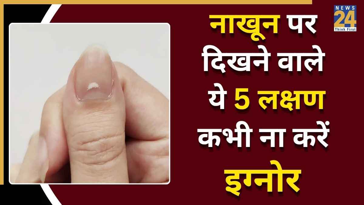 Nails Signs On Disease