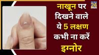 Nails Signs On Disease