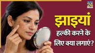 Jhaiyo ke gharelu upay