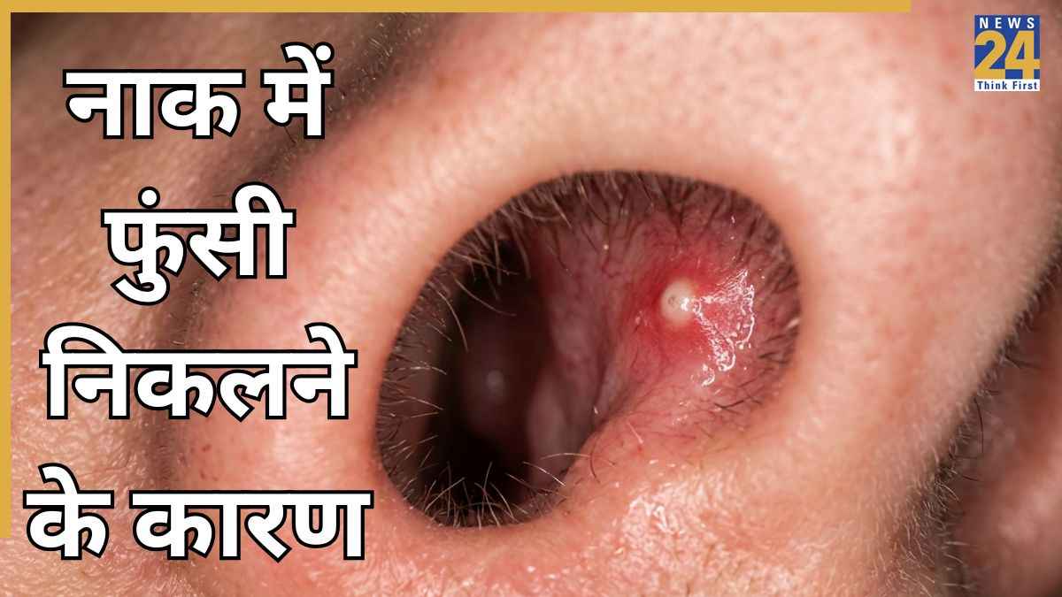 pimple in nose symptoms causes