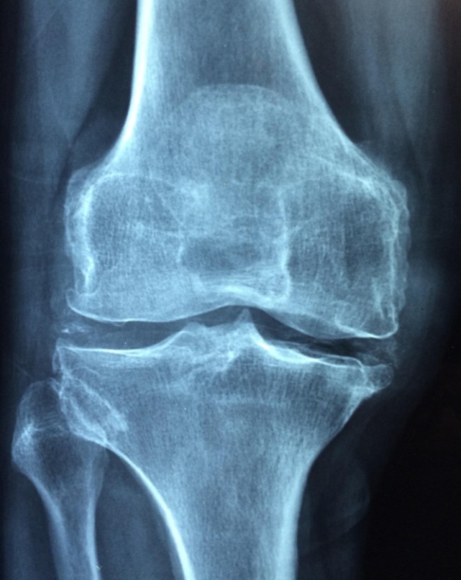 Pathar Jaisi Mazboot Haddiyan-1-2-3-4-5