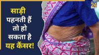 Saree cancer