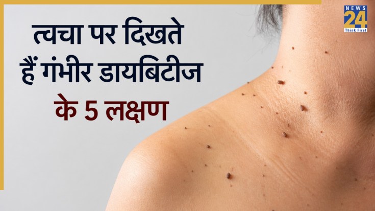 Diabetes gambhir hone ke lakshan-1
