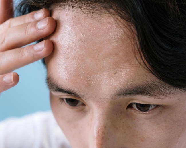 Excessive Sweating Causes-1-2-3-4-5-6-7-8