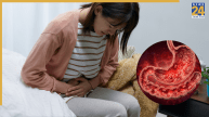 Gut Inflammation Symptoms