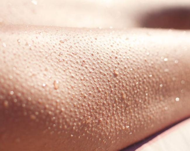 Why do we get goosebumps-1-2