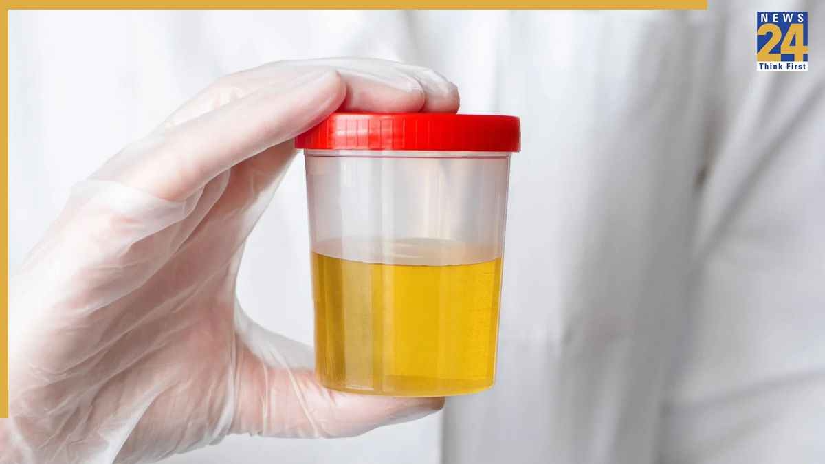 Why Urine Turns Into Yellow Colour