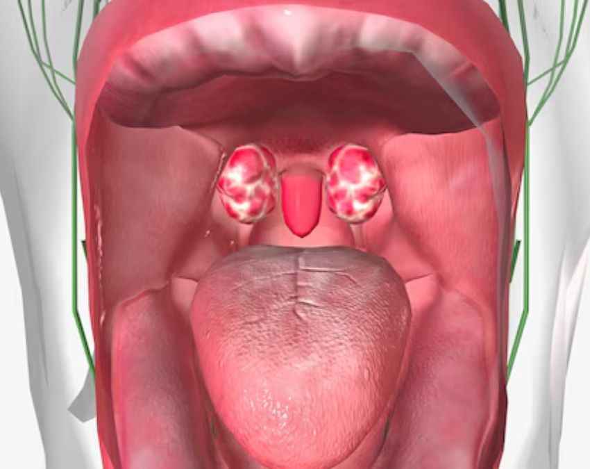 बैक्टीरियल इंफेक्शन 