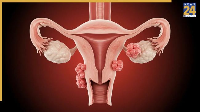 Bacchedani Kharab Hone ke lakshan Bacchedani Kharab Hone ke lakshan