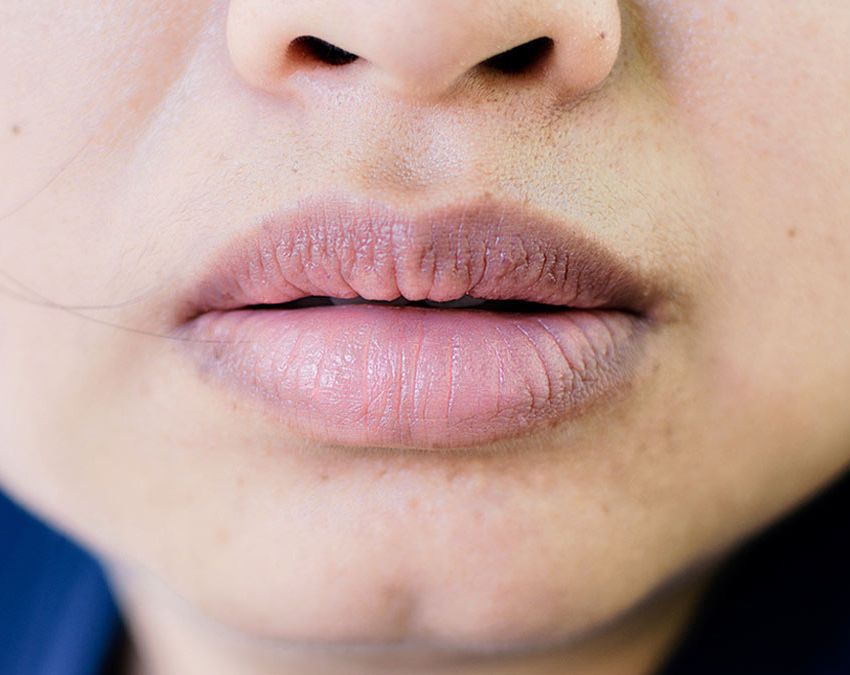 Vitamin Deficiency Lips Turning Black-1-2-3