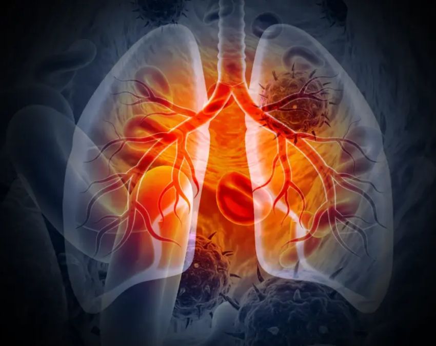 Which Colour Cough Is Dangrrous Which Colour Cough Is Dangrrous-1-2-3