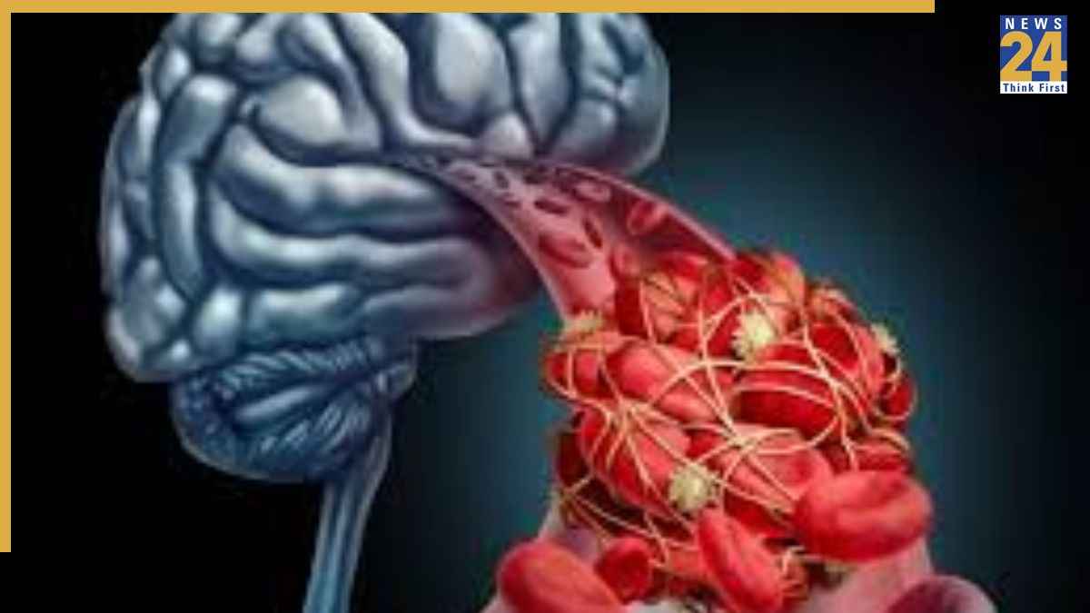 How to detect silent blood pressure