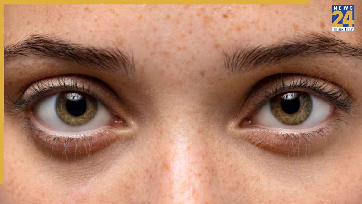 Eye Diseases Glaucoma