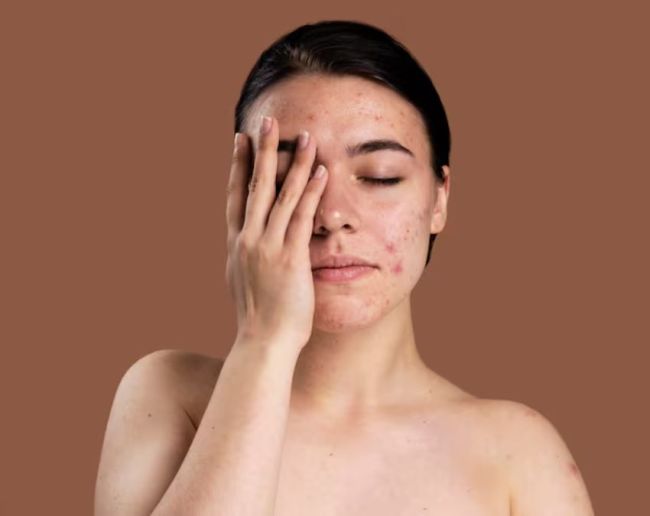 HIV Symptoms In Pregnancy Women-1-2-3