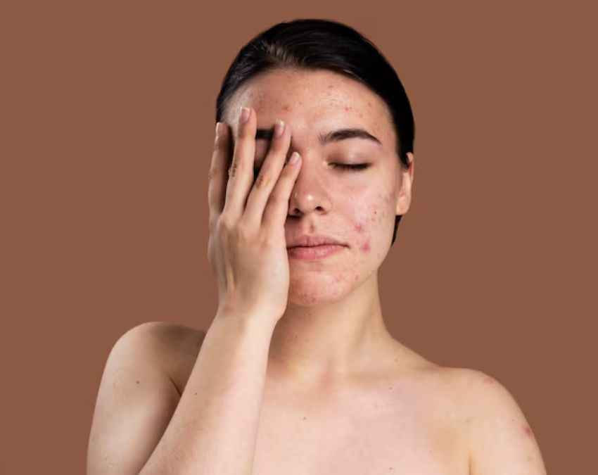 किडनी खराब होने पर स्किन क्यों बदलती है? 