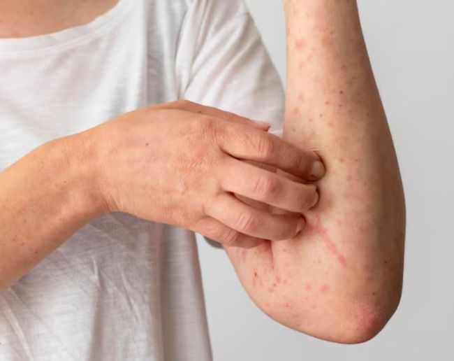 kidney damage symptoms-1-2-3-4