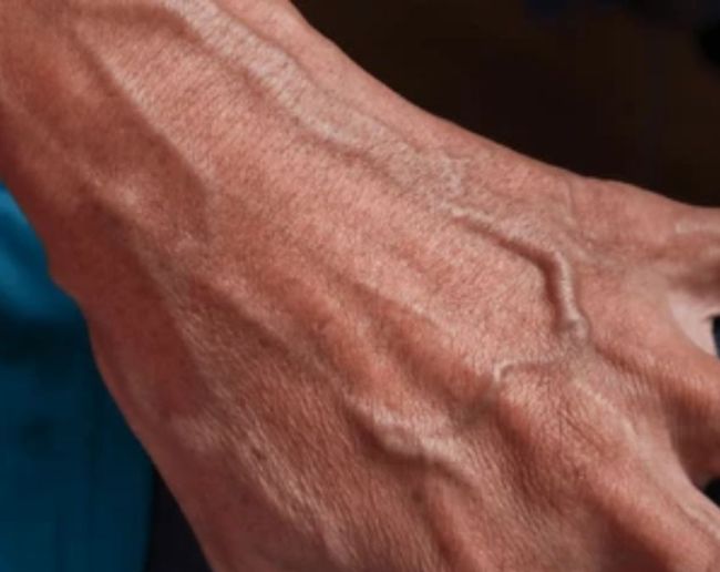 reasons for visible veins in hands-1-2-3