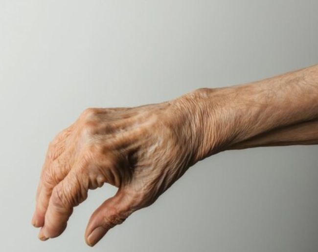 reasons for visible veins in hands-1-2-3-4