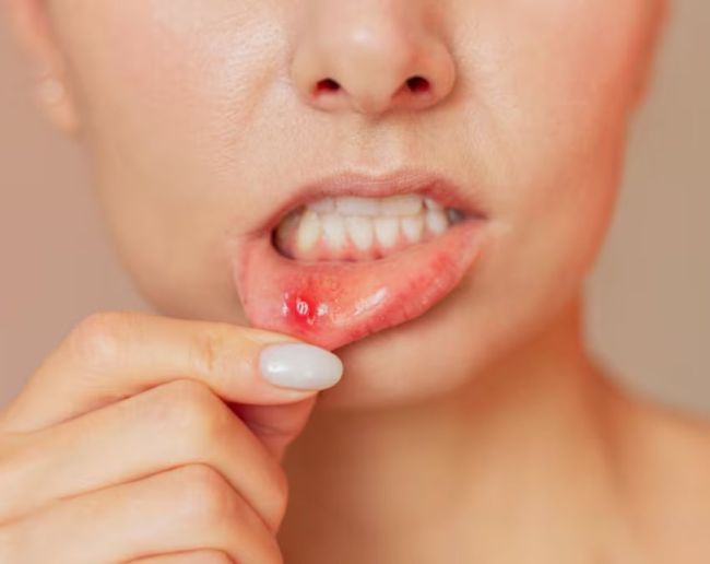 Muh Ke Chale Kaise Theek Kare-1-2