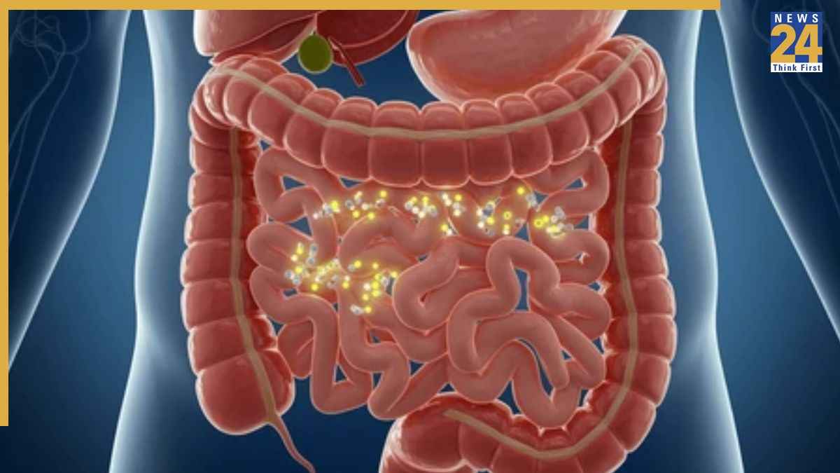 Intestinal Inflammation