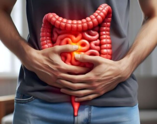 Intestinal Inflammation-1-2