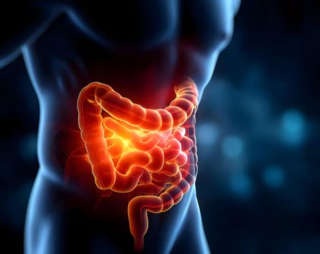 Intestinal Inflammation-1-2-3-4