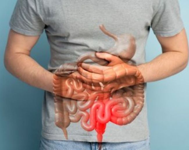 Intestinal Inflammation-1-2-3-4-5