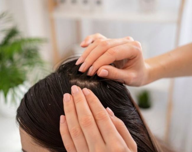 Forehead Pimples-1-2