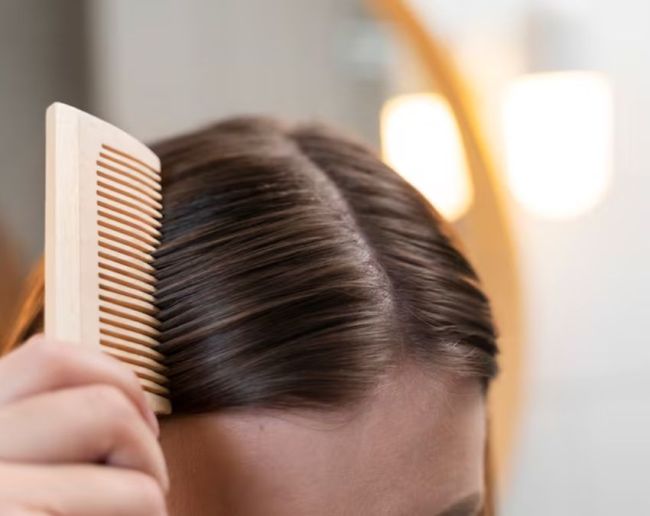 Forehead Pimples-1-2-3-4