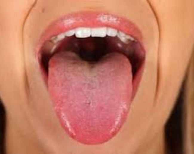 Vitamin B12 Deficiency-1-2-3