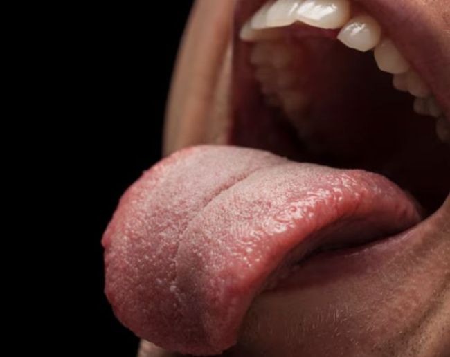 Vitamin B12 Deficiency-1-2-3-4-5