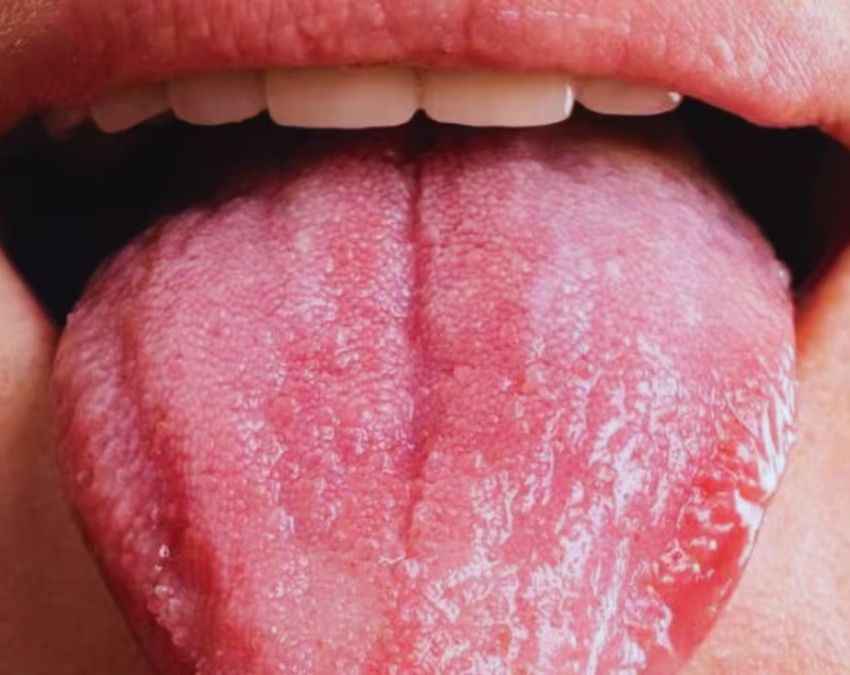 B12 की कमी का गंभीर संकेत 