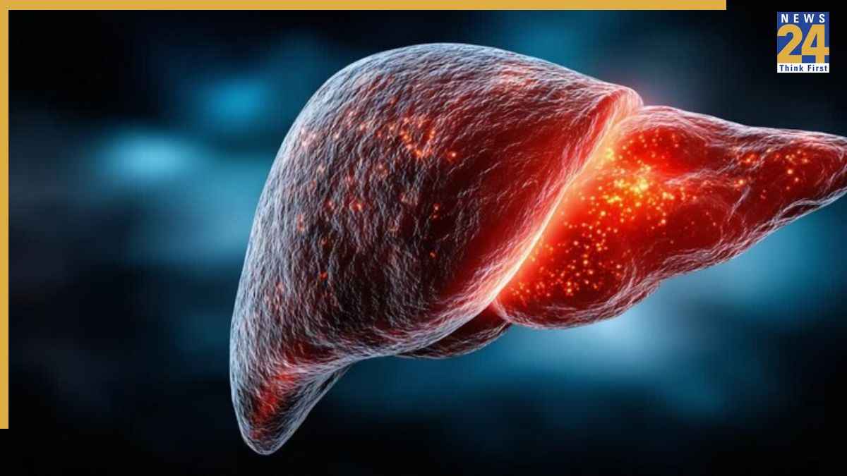 Fatty Liver Warning Sign Fatty Liver Warning Sign