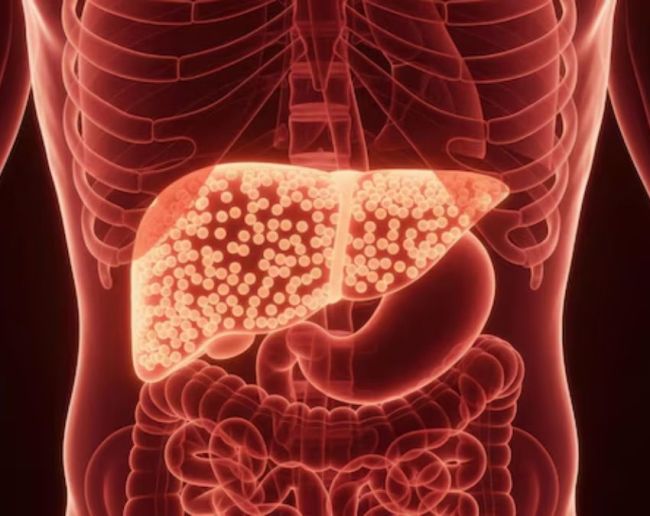 Fatty Liver Warning Sign-1-2