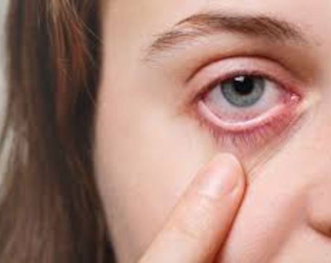 which vitamin deficiency causes eyes tears-1-2-3
