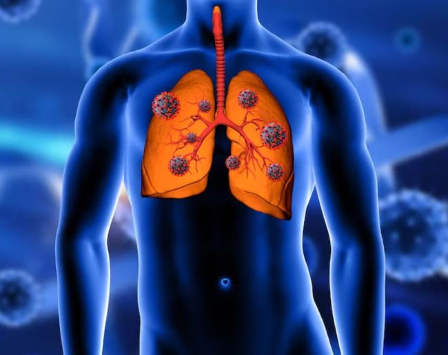 Lemon Water Benefits-1-2-3