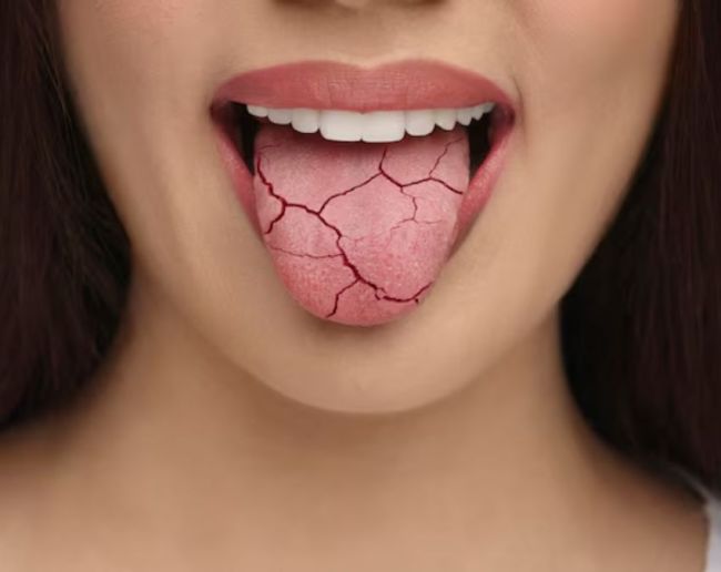 Bar Bar Muh Sukhna-1-2-3-4-5-6