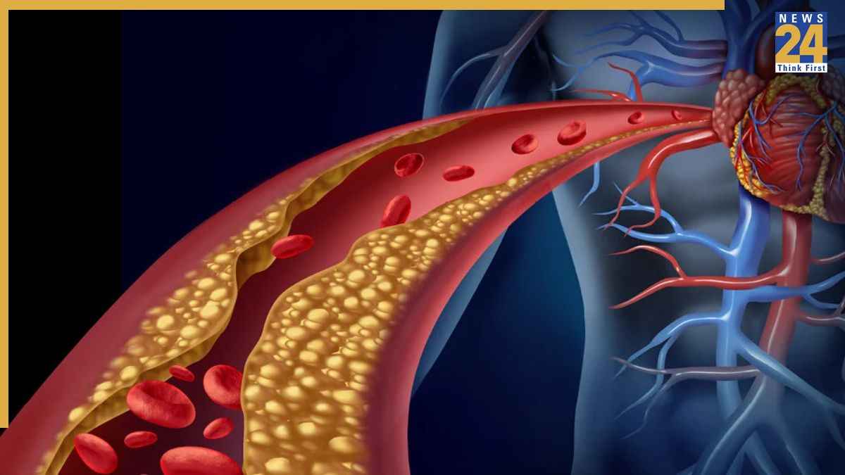 Cholesterol Increase Symptoms Cholesterol Increase Symptoms
