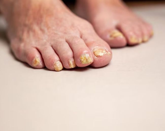 Pair Ka Rang Badalna-1-2-3-4-5-6