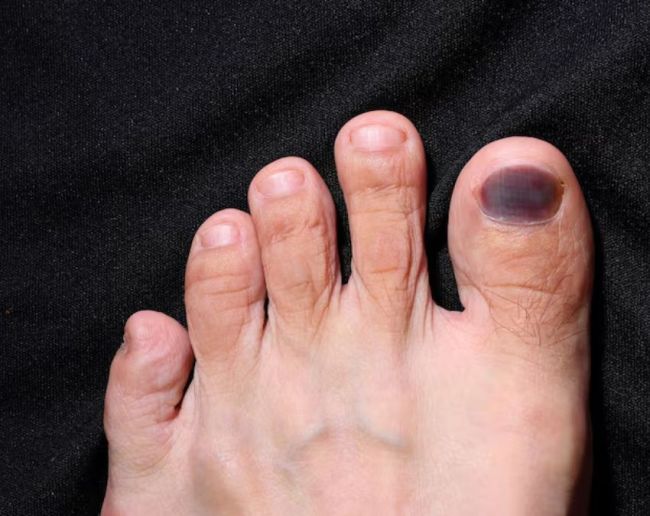 Pair Ka Rang Badalna-1-2-3-4-5-6-7