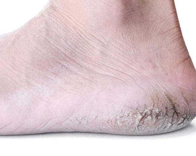 Pair Ka Rang Badalna-1-2-3-4-5-6-7-8