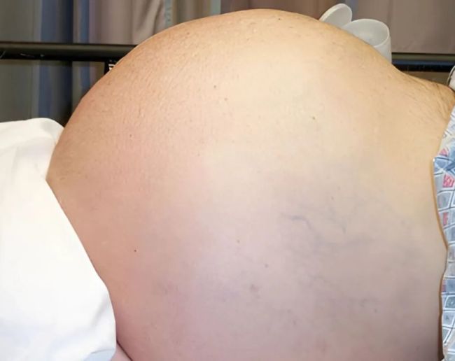 Sharir Mein Swelling Hona-1-2-3-4-5-6